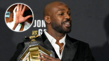 Jon Jones recalls getting into a ‘dogfight’ that gave the UFC champion a crooked finger